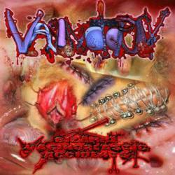 Vaginotopsy : Bizarre Vaginoplastic Accidents EP